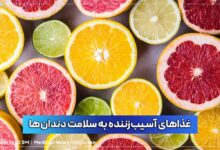 غذای مضر برای دندان