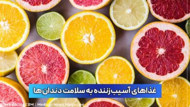 غذای مضر برای دندان