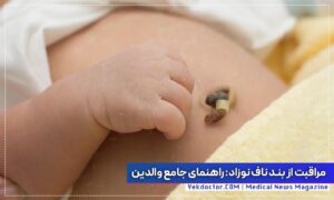 مراقبت از بند ناف