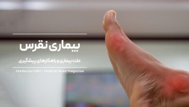 پیشگیری از بیماری نقرس