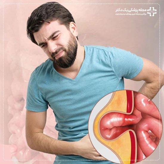 دلایل بروز فتق