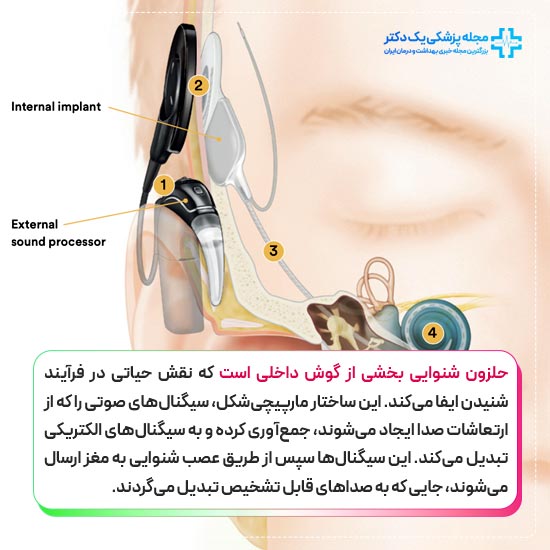 حلزون شنوایی چیست