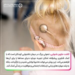 کاشت حلزون شنوایی در کودکان