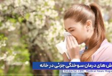 home remedies for seasonal allergies