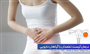 درمان کیست تخمدان