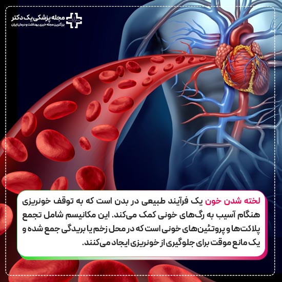 لخته شدن خون