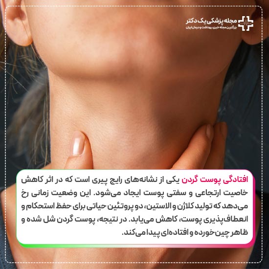 لیفت گردن چیست