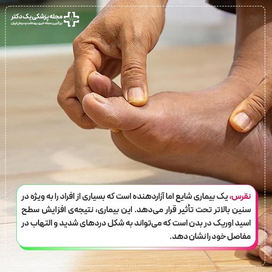 نقرس چیست