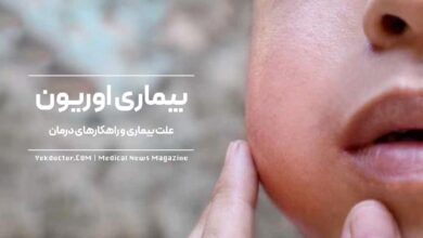 بیماری اوریون