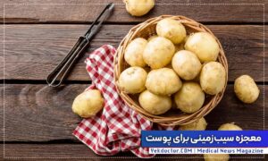 سیب زمینی