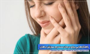 سندرم سوزش دهان
