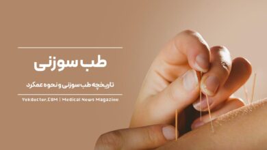 طب سوزنی