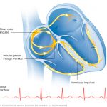 تپش قلب چیست ؟ علایم، نشانه ها و دلایل انواع تپش قلب را بشناسید