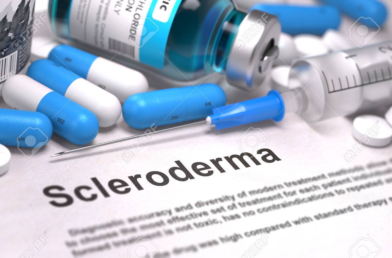 بیماری اسکلرودرما چیست ؟ دانستنی های مهم در رابطه با این بیماری