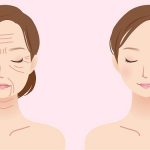 افتادگی پوست صورت و گردن ، انواع روشهای پیشگیری و درمان خانگی و پزشکی