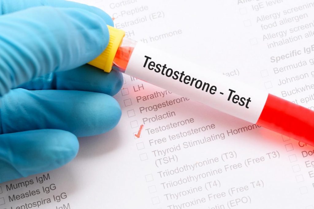 هورمون تستوسترون چیست و چه تاثیری بر روی سلامتی دارد ؟