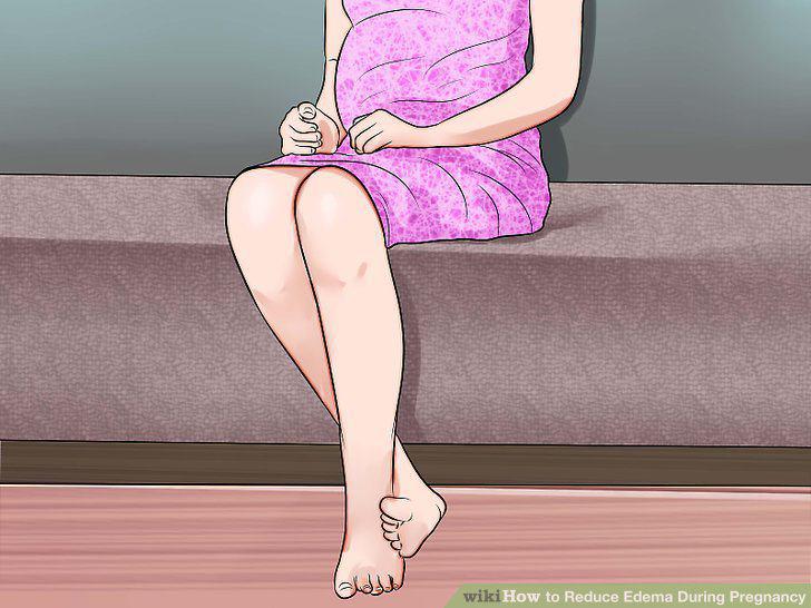 تپل شدن پا در حاملگی ؛ جلوگیری از احتباس آب در بدن در دوران بارداری