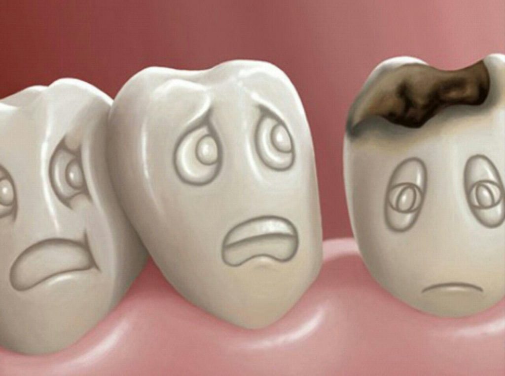 پوسیدگی دندان ؛ برای رفع پوسیدگی دندان هایمان چه کاری انجام دهیم