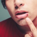 استوماتیت (stomatitis) چیست؟ روش های درمانی و علل به وجود آورنده این بیماری دهانی