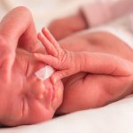 زایمان زودرس چیست؟ بررسی علل و علائم زایمان زودرس (premature birth)