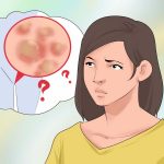 سیفلیس / هر آنچه باید درباره ی بیماری مقاربتی سیفلیس بدانید.