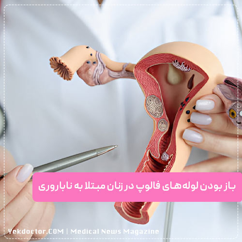 موارد استفاده از عکس رنگی رحم