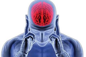 سکته مغزی چیست ؟ علایم مهم که نشانه بروز سکته مغزی می باشد.