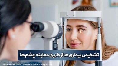 کشف بیماری ها از طریق تغییر در چشم ها