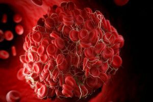 لخته شدن خون | کدام خوراکی ها لخته شدن خون را مهار میکنند؟