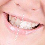 سلامت دهان و دندان |کدام مواد غذایی باعث سلامت دهان و دندان میشوند؟