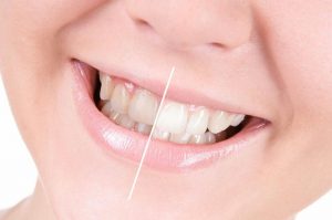 سلامت دهان و دندان |کدام مواد غذایی باعث سلامت دهان و دندان میشوند؟