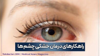 راهکارهای درمان خشکی چشم ها