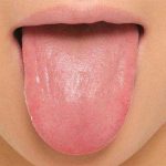 سندرم سوزش دهان |توصیه هایی برای افرادی که سندرم سوزش دهان دارند