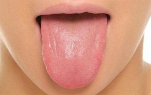سندرم سوزش دهان |توصیه هایی برای افرادی که سندرم سوزش دهان دارند