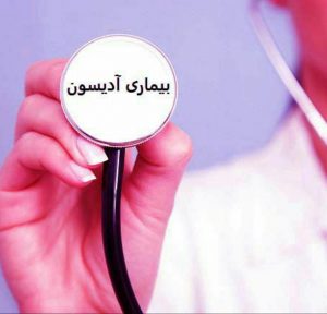 علل و علائم بیماری آدیسون چیست و چگونه بیماری آدیسون را درمان کنیم؟