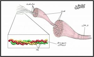 اسکلرودرمی