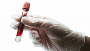 بیماری نقرس