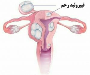 منوراژی