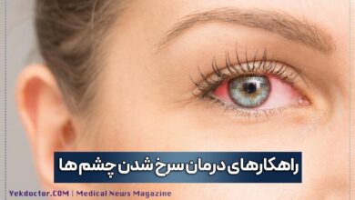 راهکارهای درمان سرخ شدن چشم ها