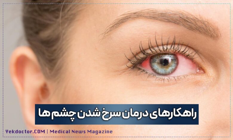 راهکارهای درمان سرخ شدن چشم ها
