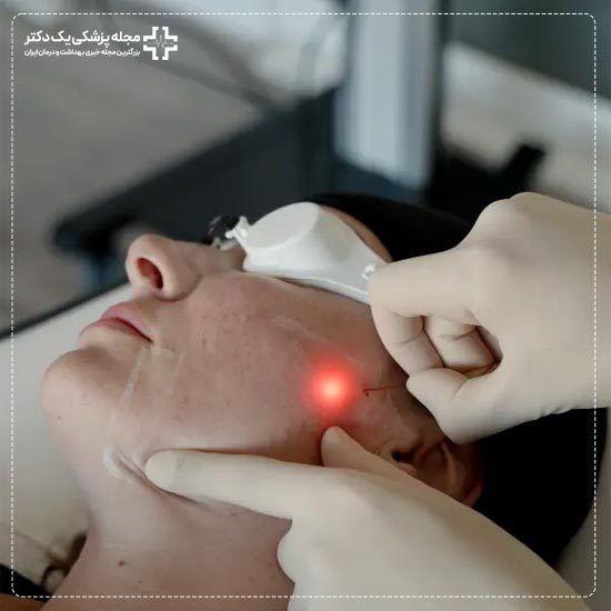 اندولیفت برای زاویه سازی