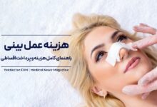 هزینه عمل بینی در کلینیک زیبایی نورسا