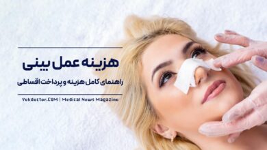 هزینه عمل بینی در کلینیک زیبایی نورسا