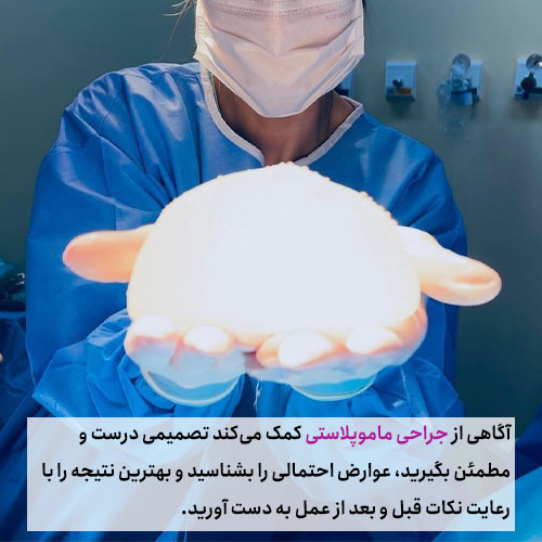جراحی ماموپلاستی