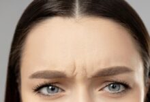 سن مناسب تزریق بوتاکس