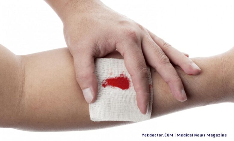 درمان عفونت زخم