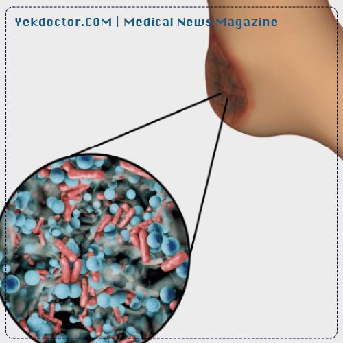 عفونت زخم پا