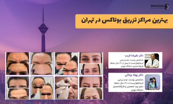 بهترین مراکز تزریق بوتاکس تهران