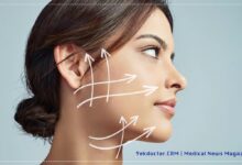 زاویه سازی صورت و فک