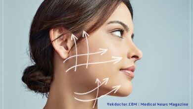 زاویه سازی صورت و فک